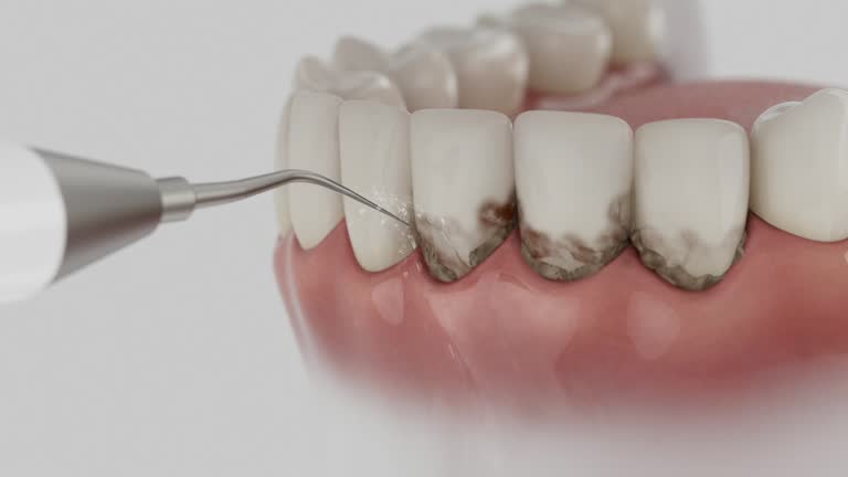 Trusted Tooth Extraction service in Bridgeport, OH - Dentist Open Now